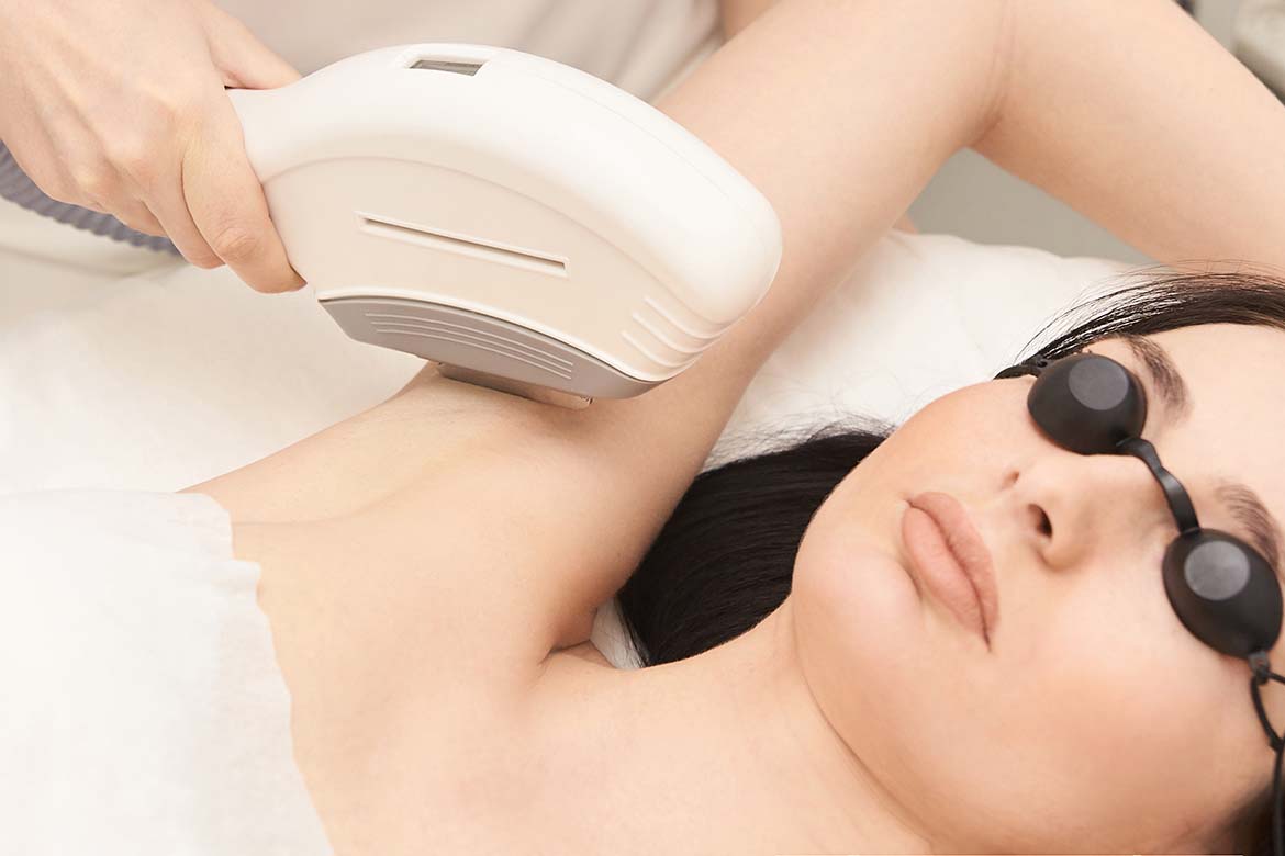 hair laser removal