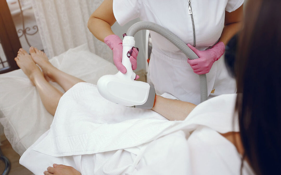 5 Benefits of Laser Hair Removal for Women