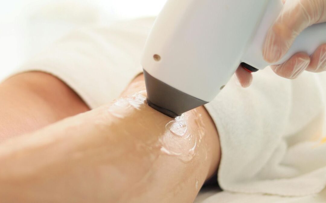 Laser Hair Removal Bundle Deals in Etobicoke: Get More Treated Areas for Less
