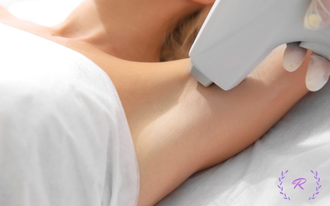 laser hair removal revitalize etobicoke