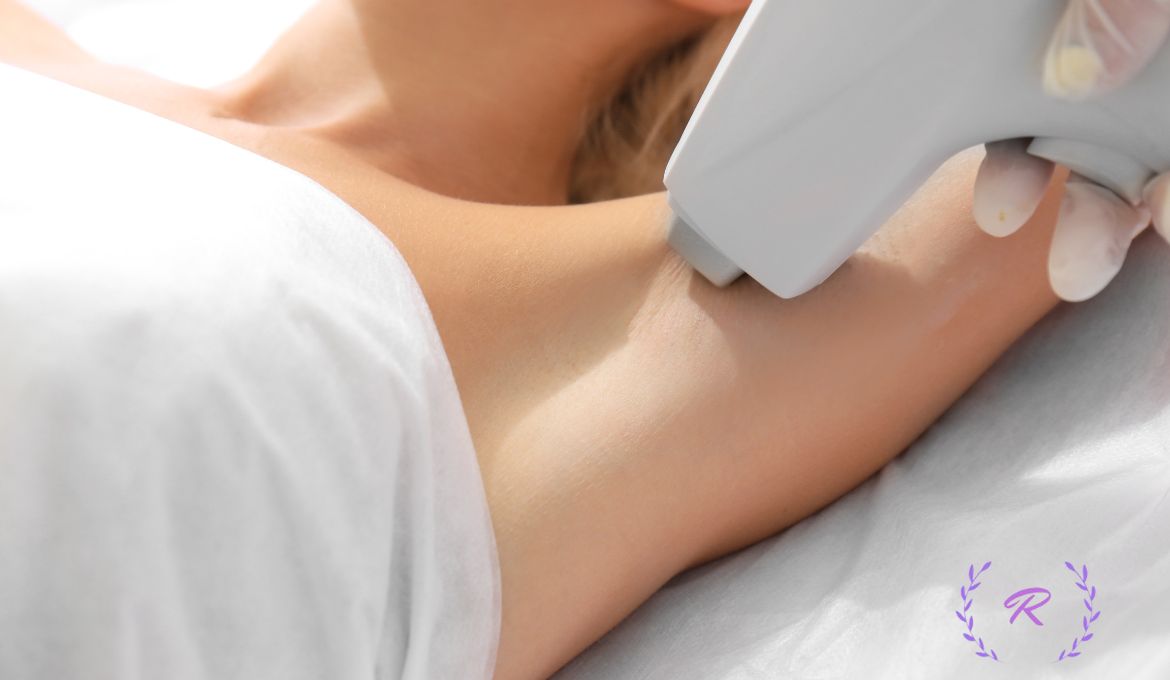 laser hair removal revitalize etobicoke