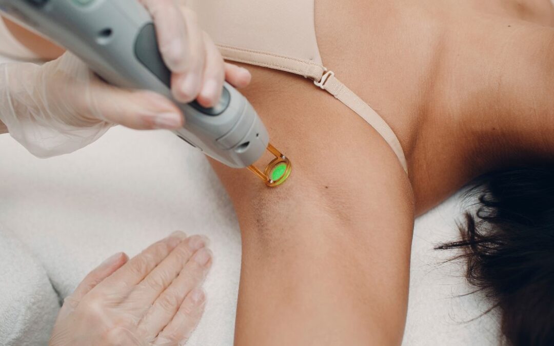 laser removal etobicoke Revitalize