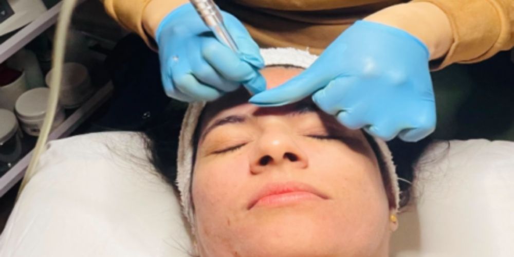 microdermabrasion revitalize spa etobicoke